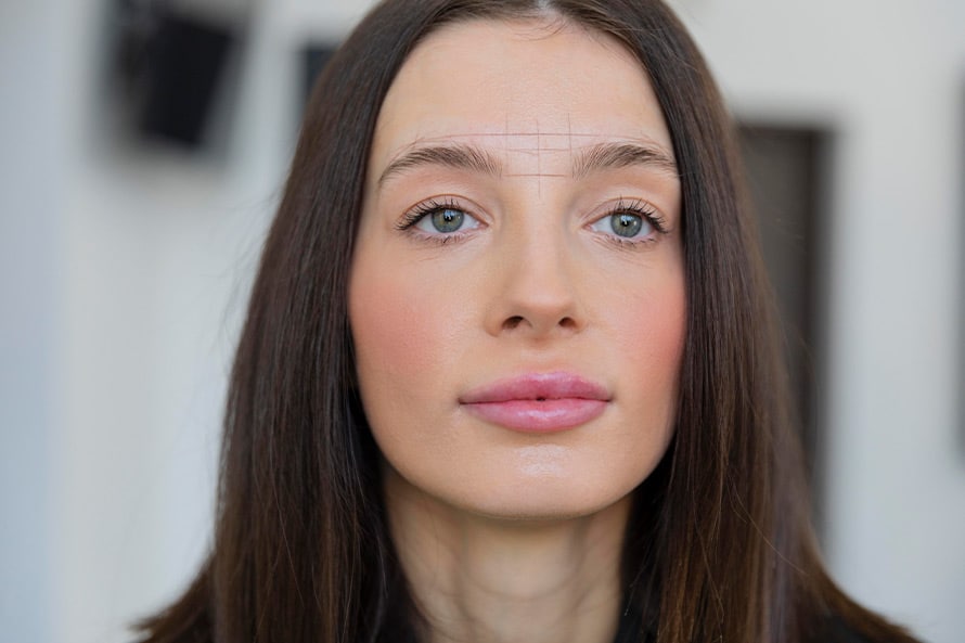 aplicaciones-funcionales-de-la-blefaroplastia