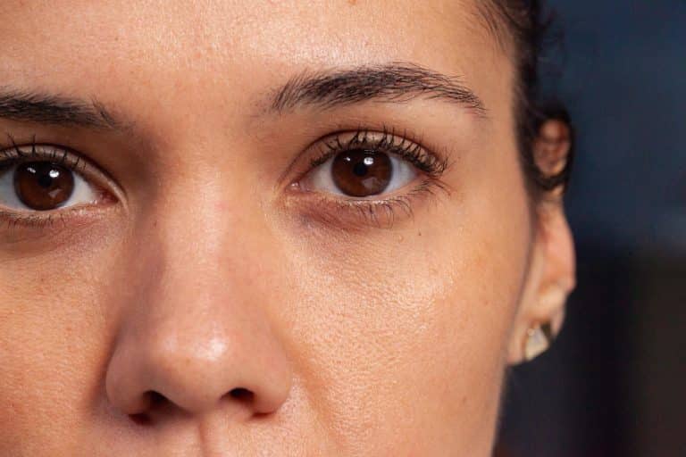 beneficios de la blefaroplastia