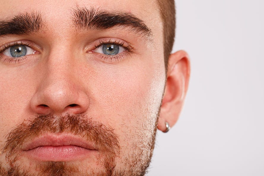 blefaroplastia-masculina