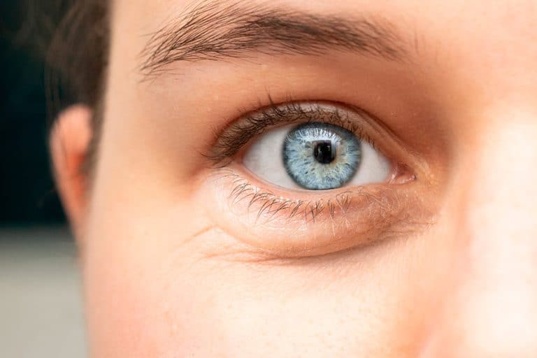 blefaroplastia-y-ojeras