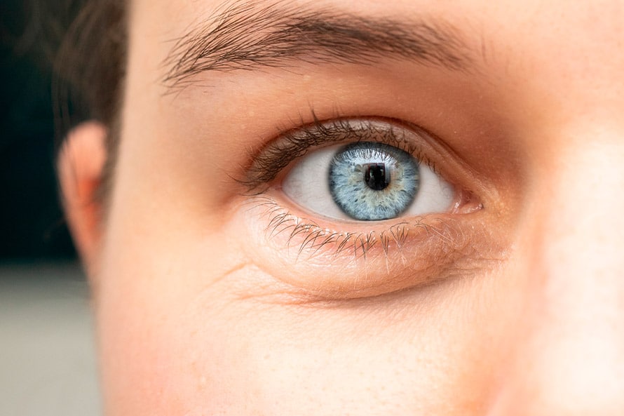 blefaroplastia-y-ojeras