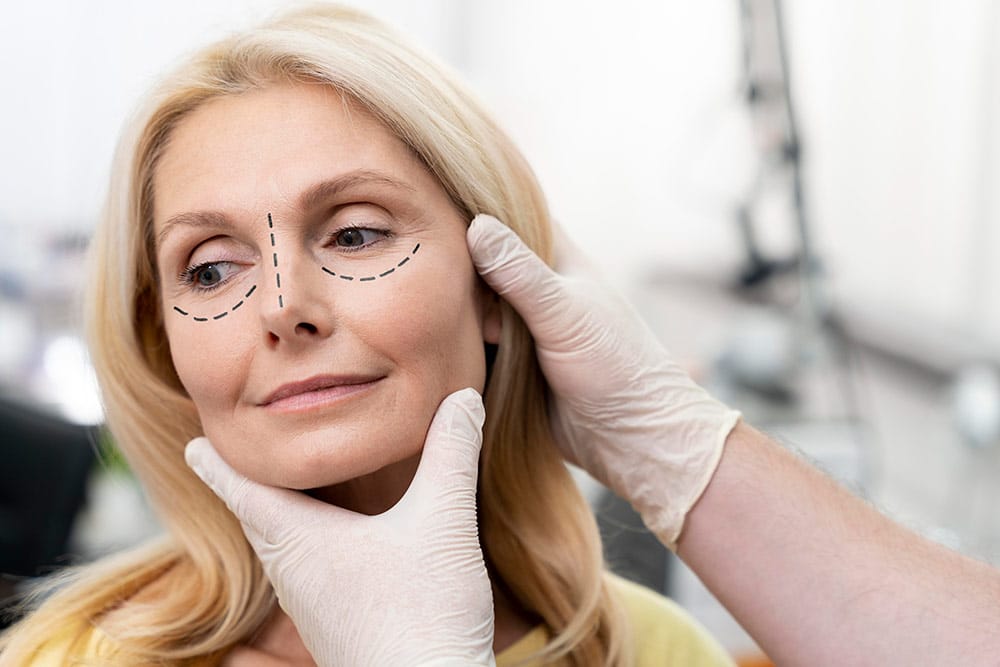 edad-ideal-blefaroplastia