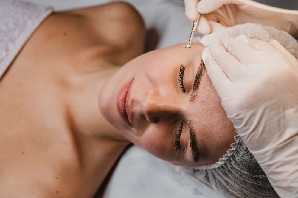 mesoterapia facial
