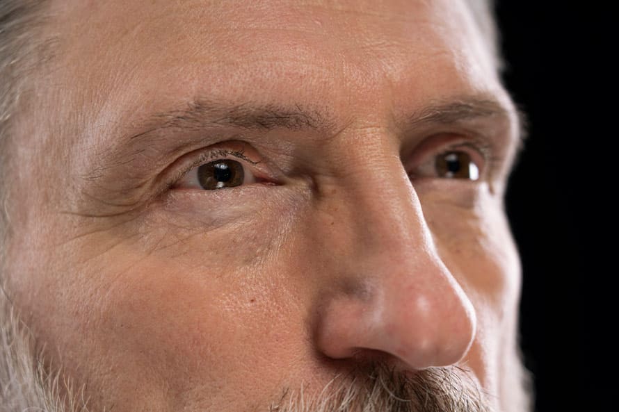 operacion-bolsas-ojos-hombre